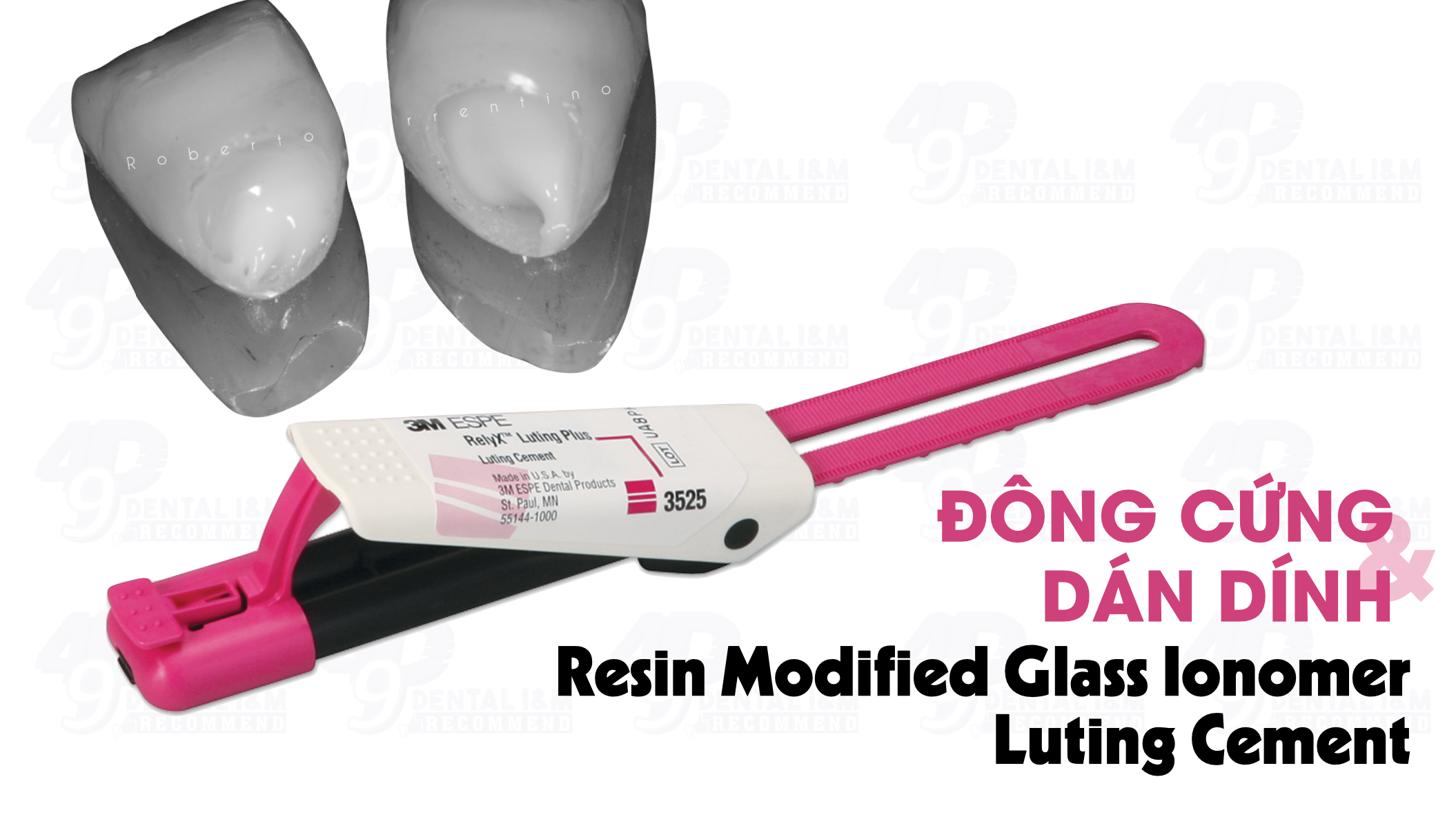 Cement nha khoa: Cơ chế đông cứng & dán dính của Cement Resin Modified Glass Ionomer - RMGI