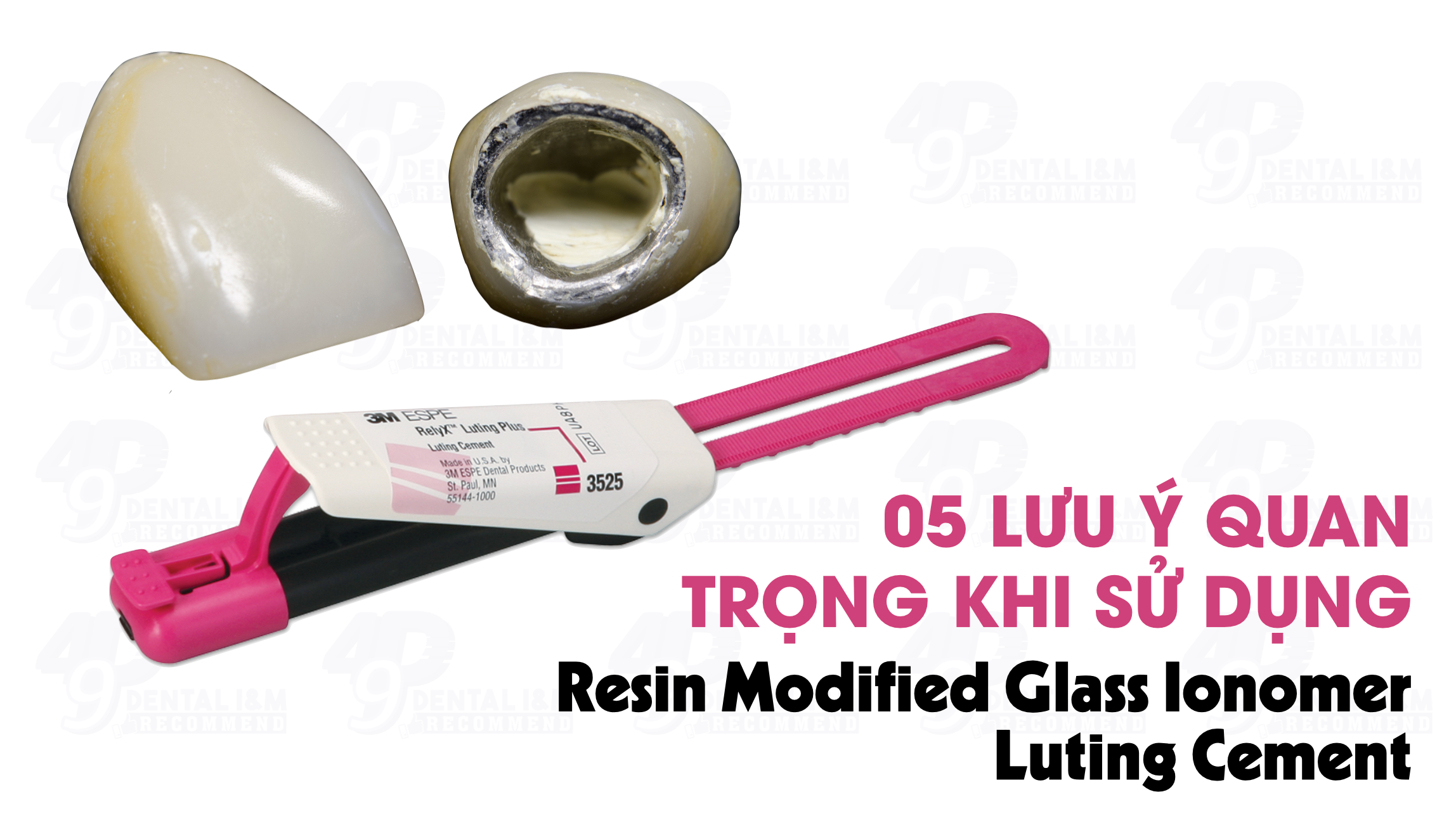 Cement nha khoa: 05 lưu ý quan trọng khi sử dụng cement RMGI