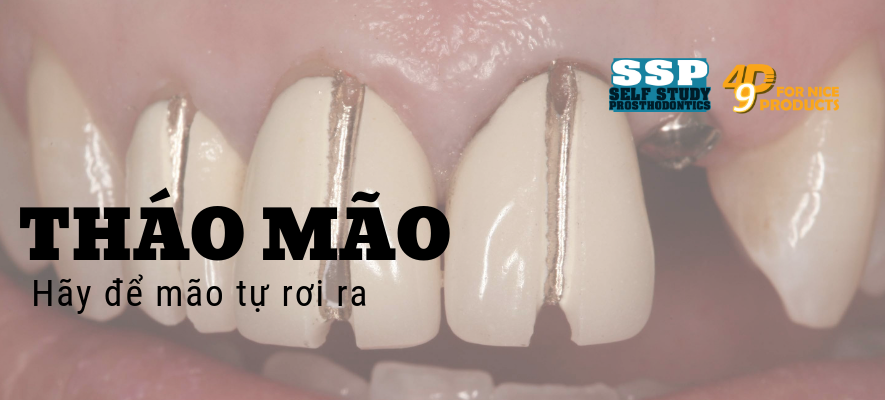 Tháo mão: HÃY ĐỂ MÃO TỰ RƠI RA!!!