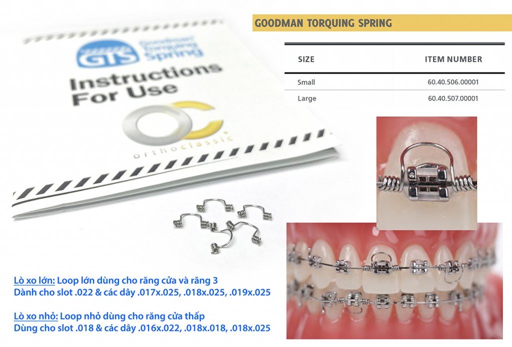 Lò Xo Lực Torque Goodnam - Ortho Classic