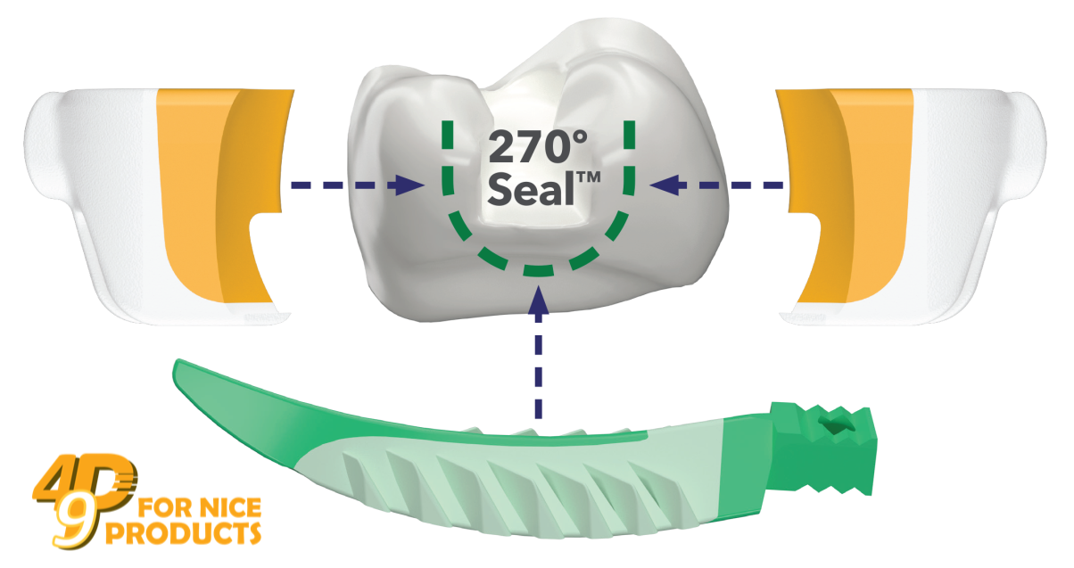 Vòng giữ khuôn trám Strata-G™ - Garrision