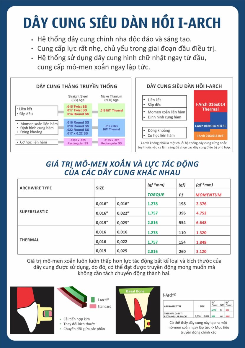 Dây Cung Siêu Đàn Hồi I-Arch - SIA