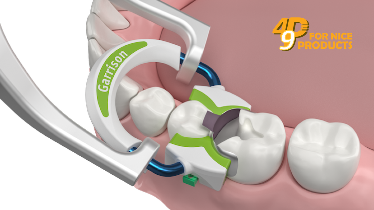Vòng giữ khuôn trám Strata-G™ - Garrision