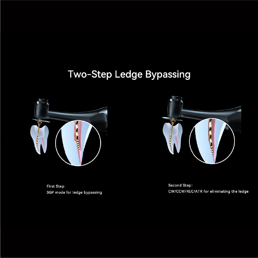 Máy điều trị nội nha tích hợp định vị chóp 812 Endo Motor - Woodpecker