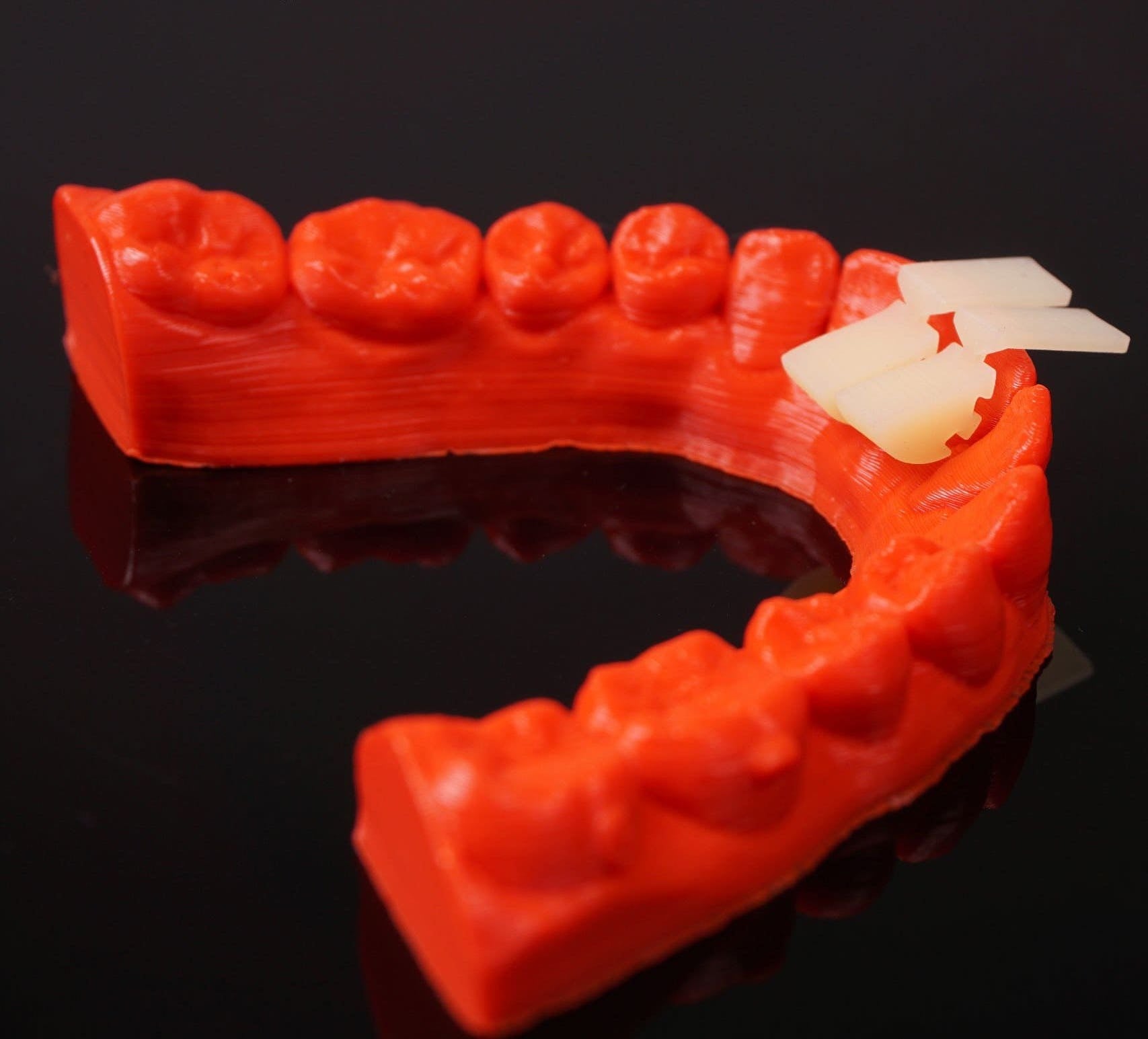 Nút Nâng Khớp (Bite Turbo) - Singapodent