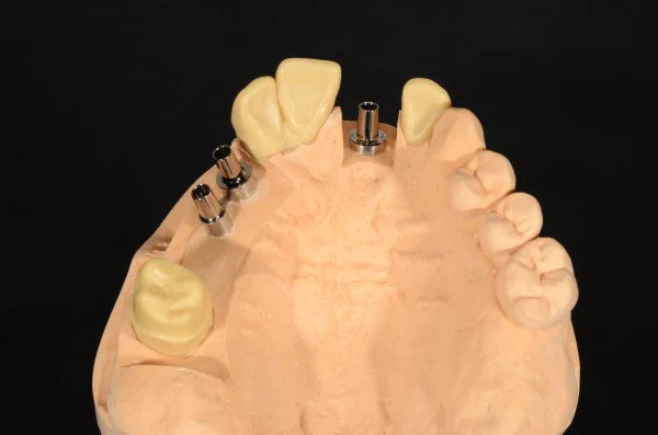 Nhựa trong quang trùng hợp làm khoá chuyển Implant Luka Clear - Lukadent