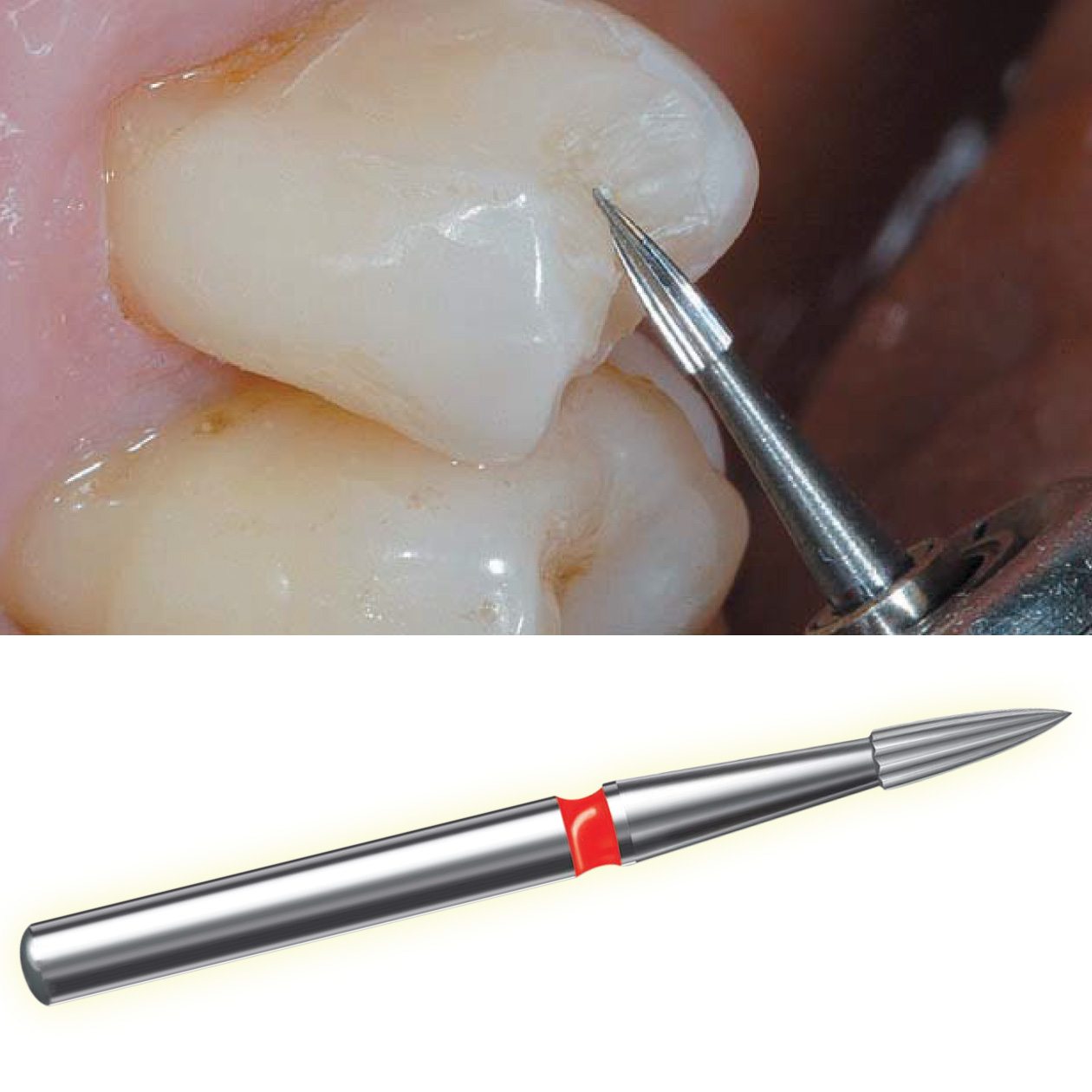 Mũi khoan hoàn tất - Finishing Carbide Burs - NTI