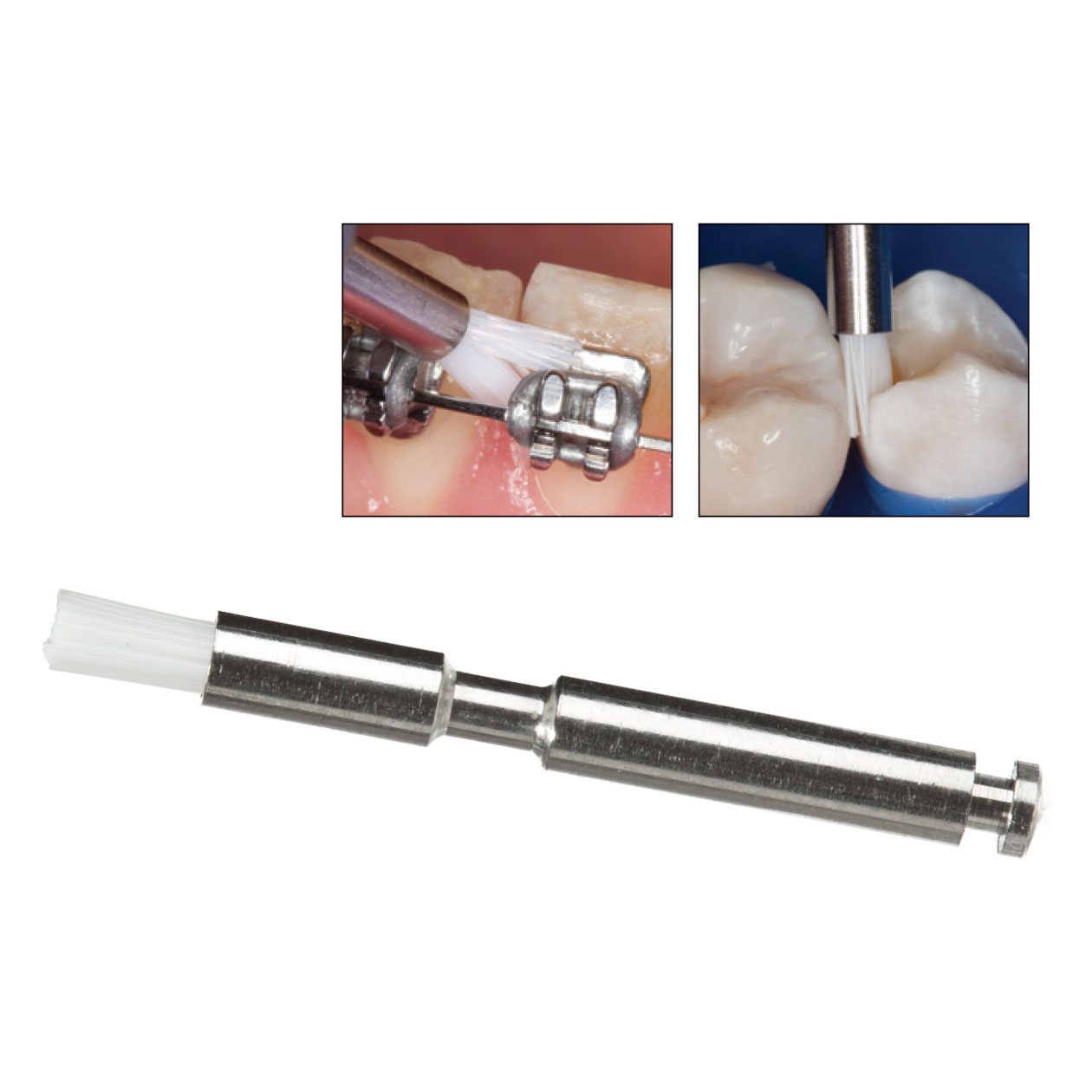 Chổi làm sạch các vùng khó vào STARBRUSH - Ultradent