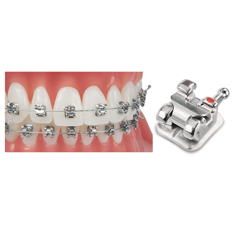Mắc cài kim loại tự buộc SensationM - Ortho Technology