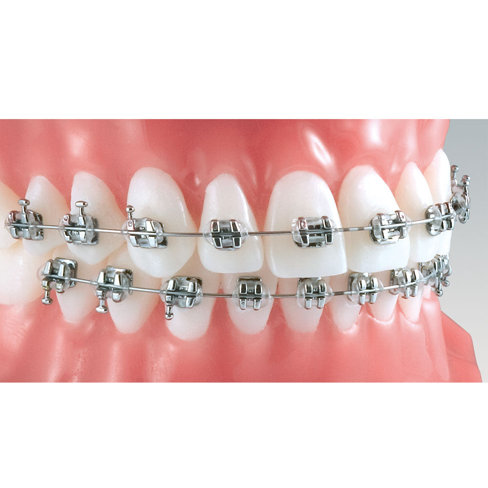 Mắc cài kim loại thường Bionic Bio Progressive - Ortho Technology