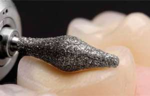 Bộ mũi mài Onlay mặt nhai 4665 - Komet