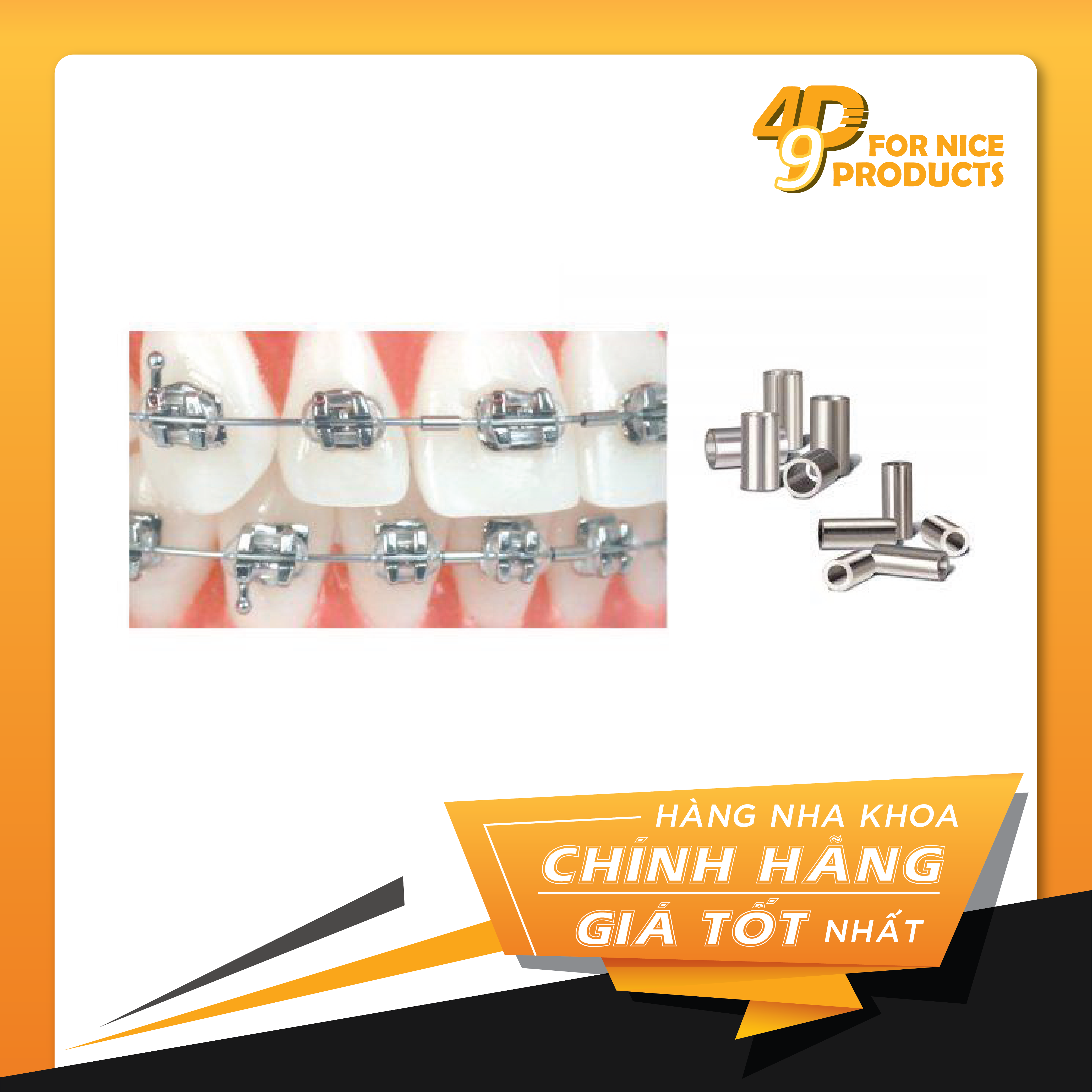 Ống Stop trên dây chỉnh nha - Ortho Technology