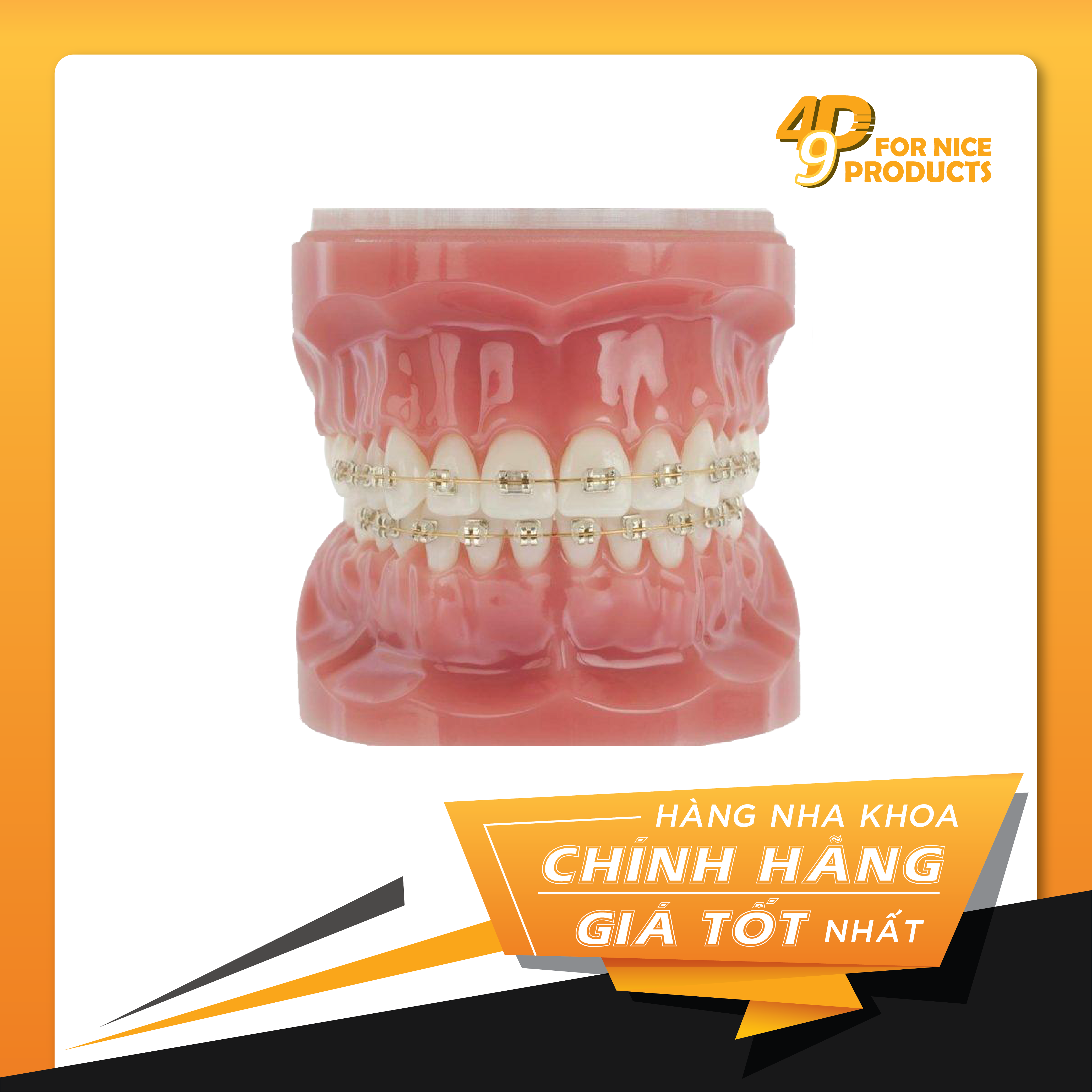 Mắc cài Vàng ICONIX - American Orthodontics