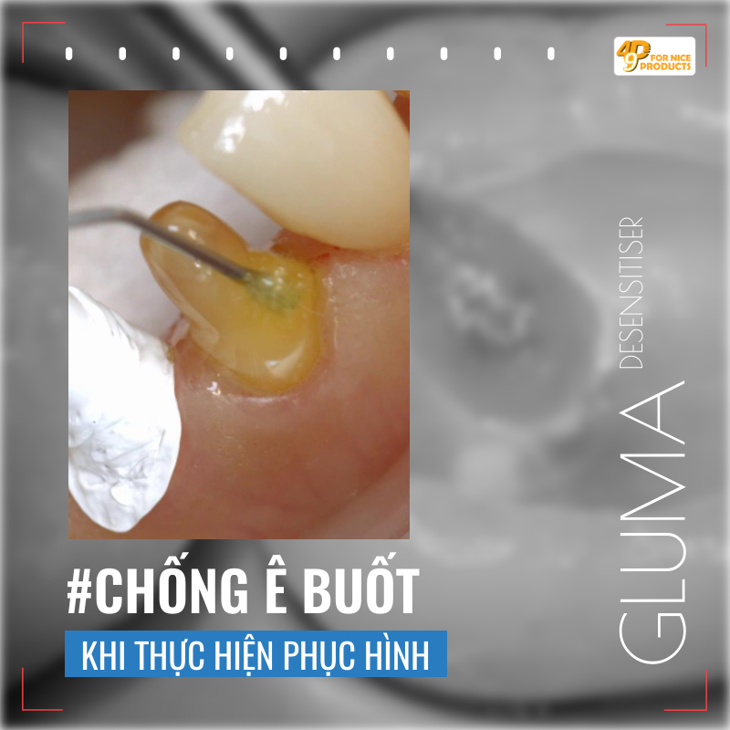 dung-dịch-sát-trùng-xoang,-chống-ê-buốt---gluma---kulzer-49p.vn