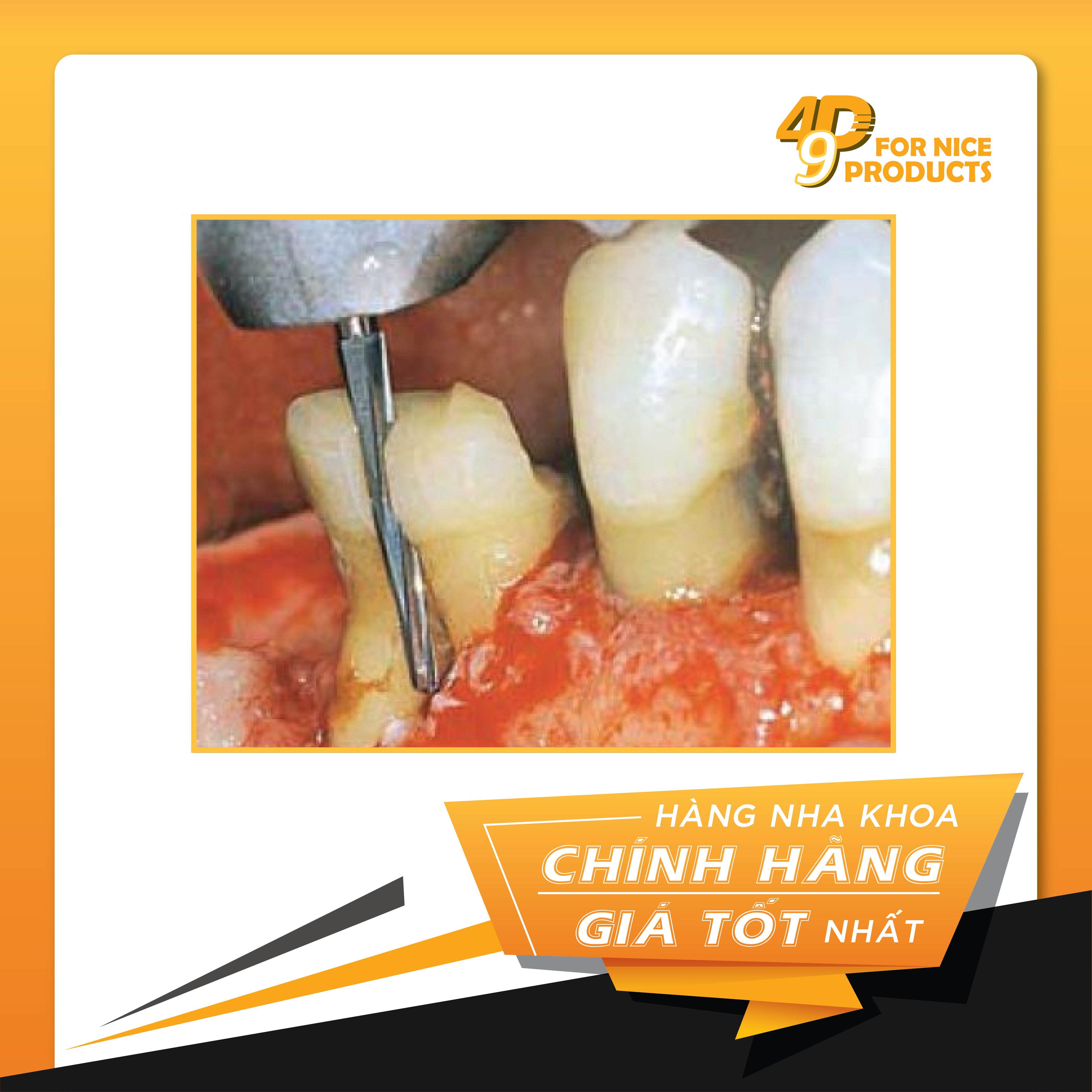 Mũi khoan phẫu thuật Surgery Burs - NTI