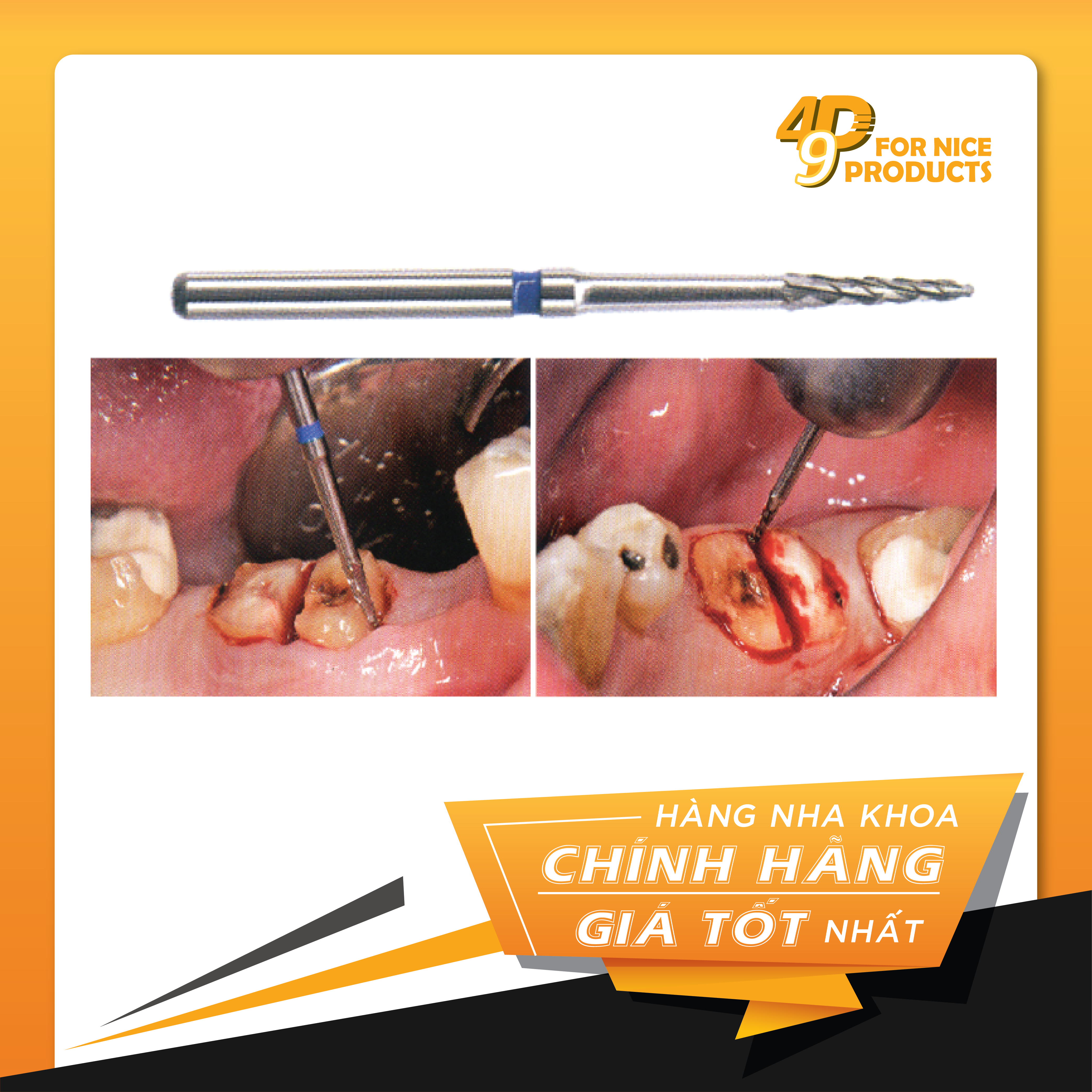 Mũi khoan phẫu thuật Surgery Burs - NTI