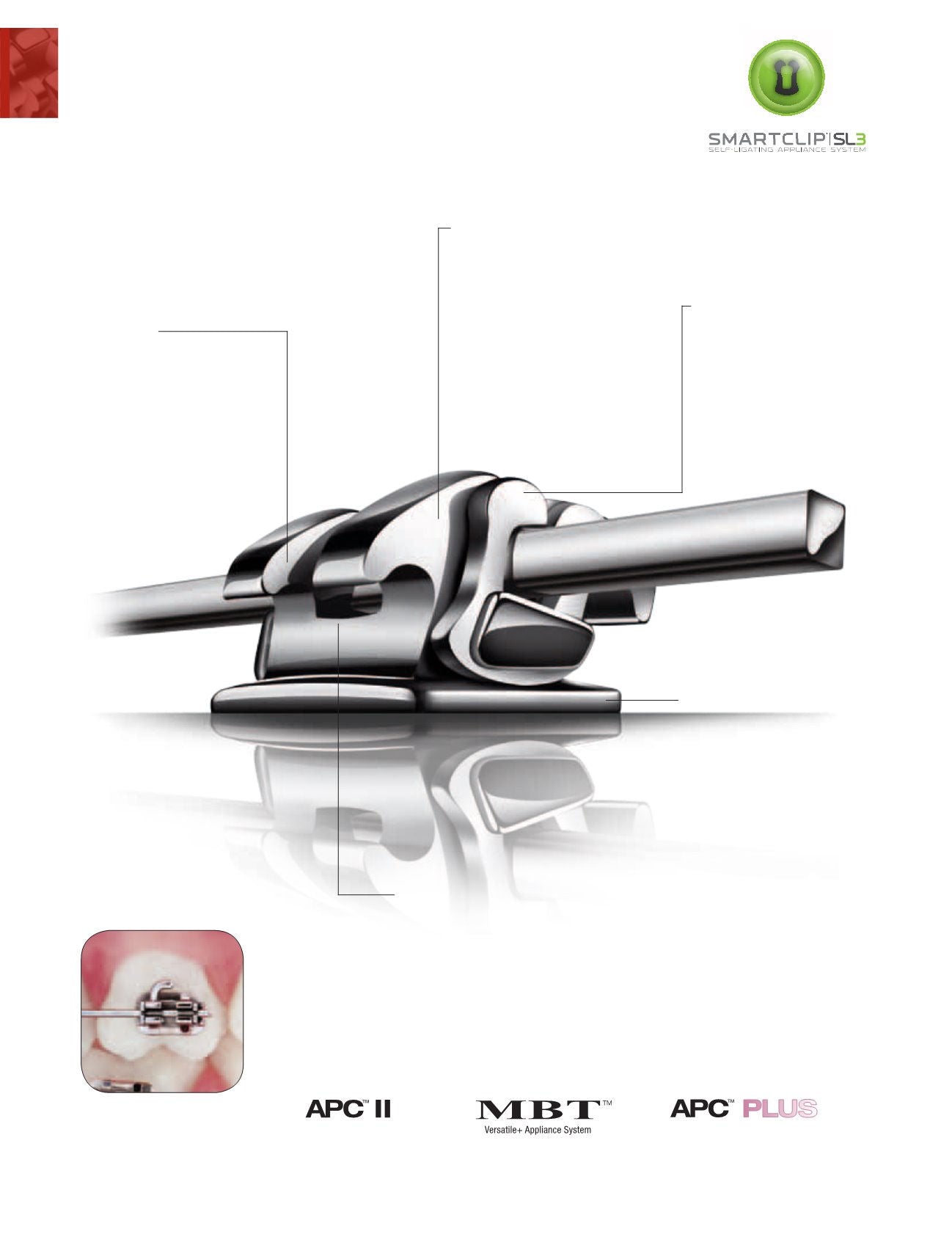 Mắc cài kim loại tự buộc SmarClip MBT -3M