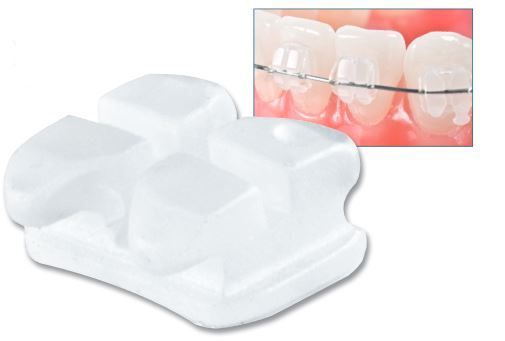 Mắc cài sứ Gemini Clear - 3M