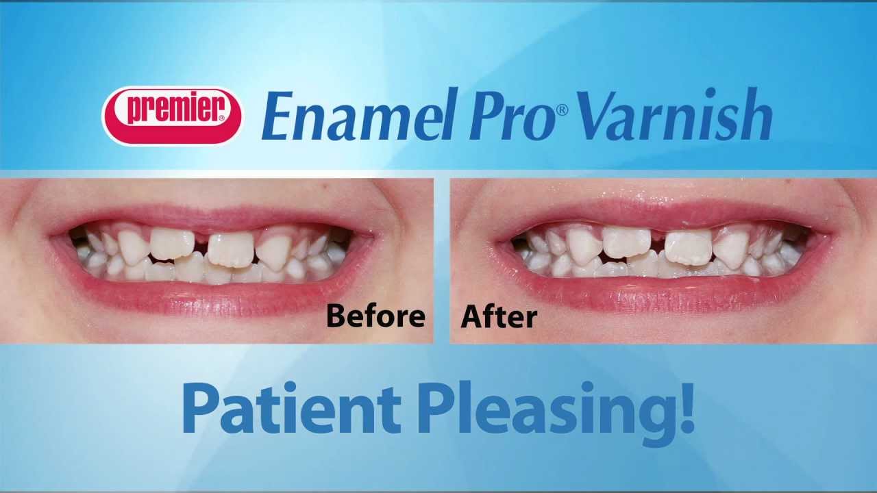 enamel-pro-varnish---premier-49p.vn