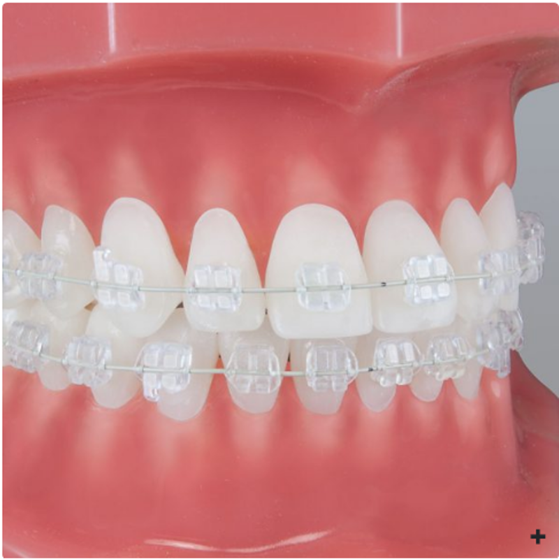 Mắc cài sứ Sapphire PURE - Ortho Technology