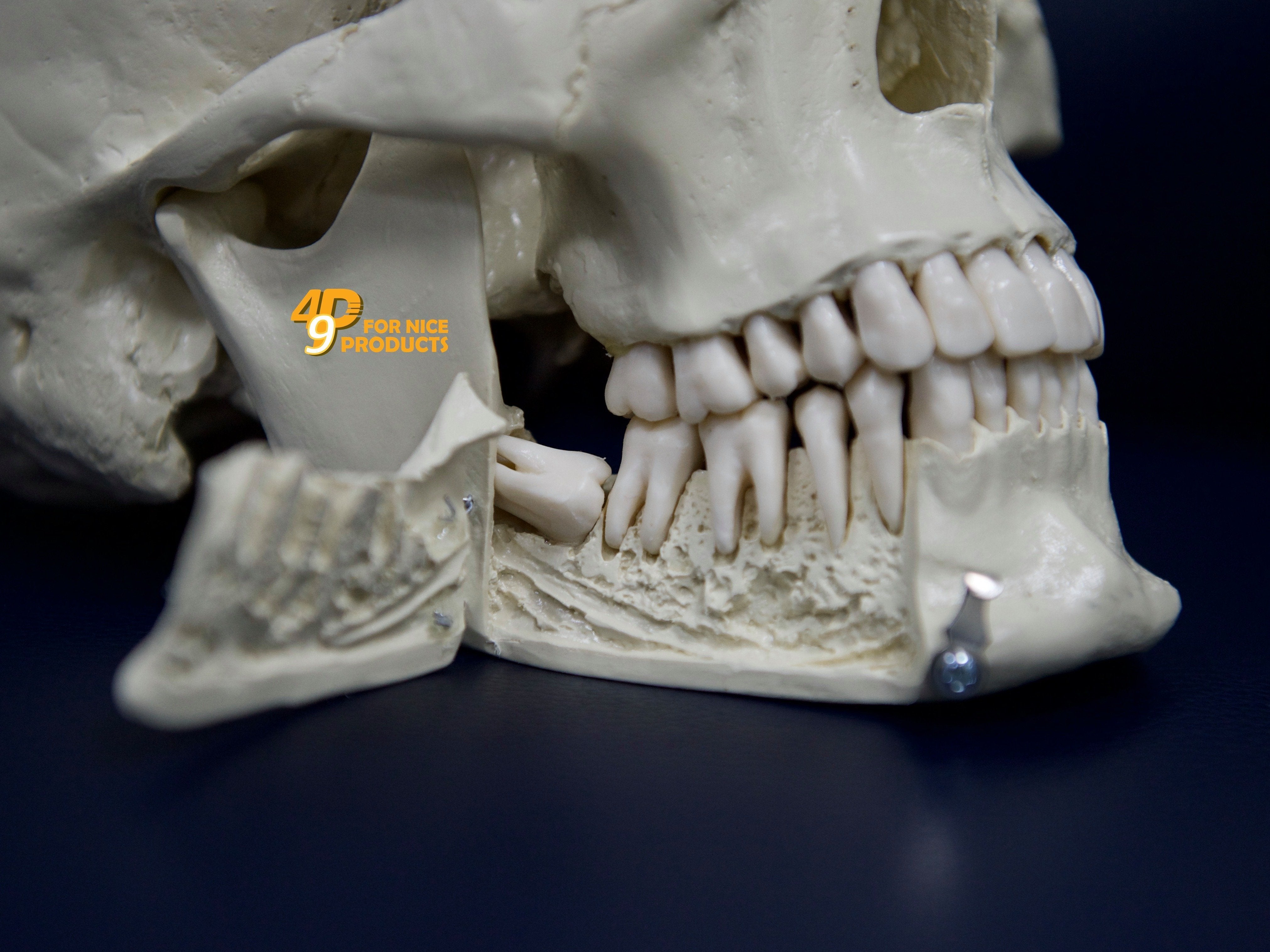 sọ-nhựa-thực-hành-chỉnh-nha-pos.-49p.vn
