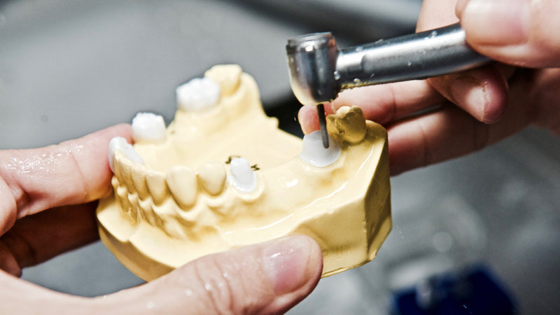 Quy trình thực hiện Cầu Răng - Phần 2: ĐỪNG LẠC HƯỚNG khi mài Cầu Răng