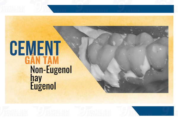 Cement Nha khoa: Cement gắn tạm Non-Eugenol hay Eugenol