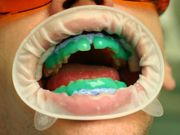 Những quan niệm mới trong tẩy trắng răng sẽ giúp quý vị phát triển việc thực hành lâm sàng của quý vị !
