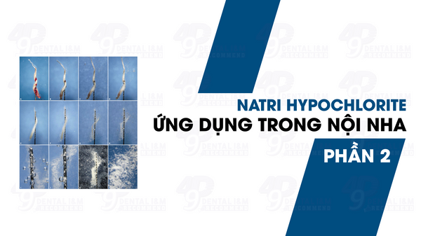 Natri Hypocloride (NaClO) và ứng dụng trong nội nha - P2