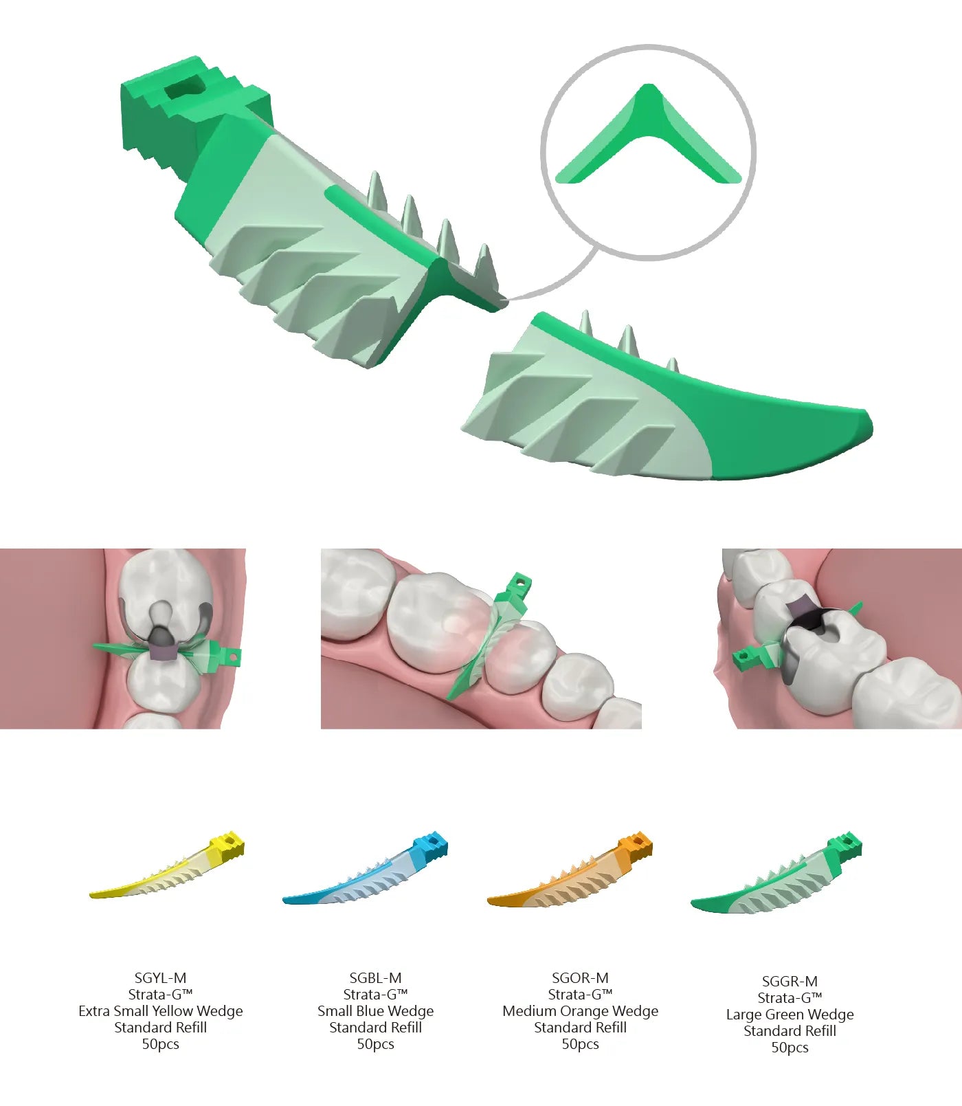 Chêm nhựa có gai phiên bản mới Strata-G™ - Garrison