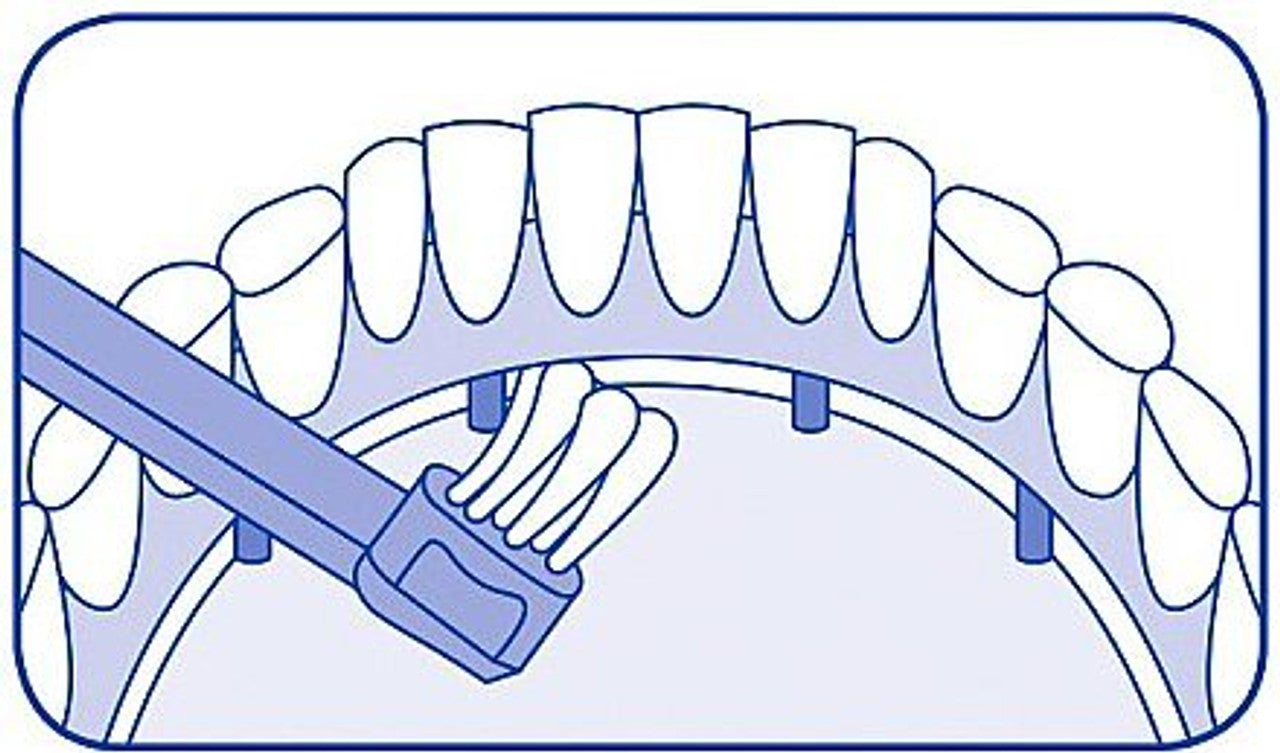 Bàn chải răng niềng, implant CS 708 - Curaprox
