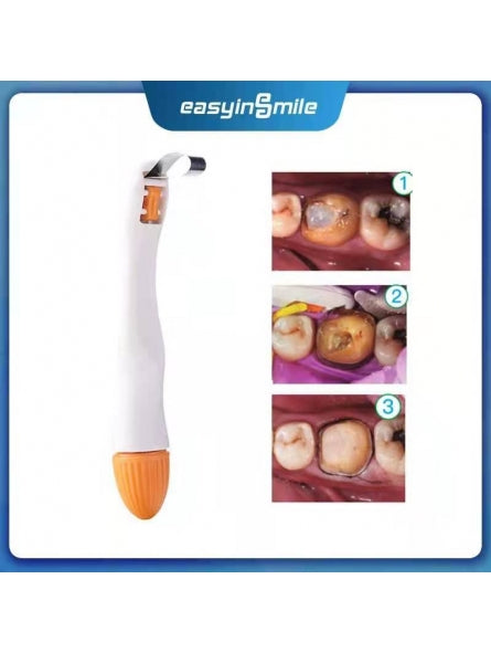 Khuôn trám toàn phần có bao gồm cây giữ khuôn dùng 1 lần - Easy in Smile