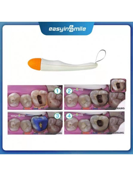 Khuôn trám toàn phần có bao gồm cây giữ khuôn dùng 1 lần - Easy in Smile