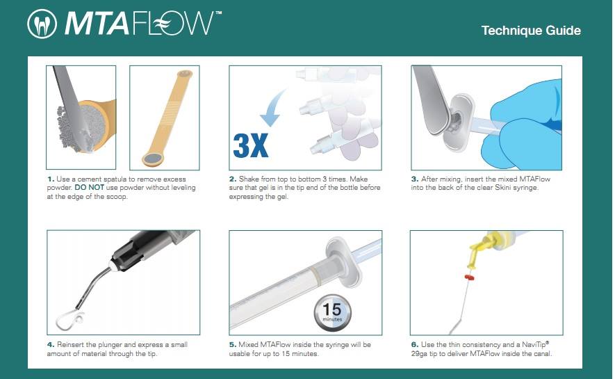 mta-flow---Điều-trị-tủy-49p.vn