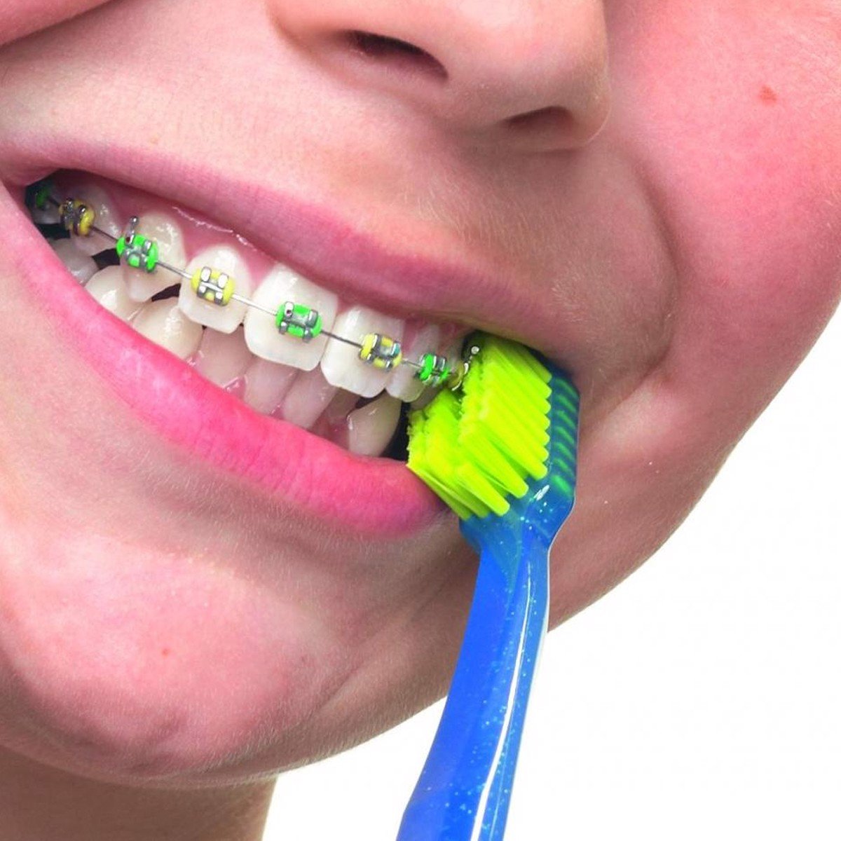 Bàn chải cho niềng răng CS 5460 Ortho - Curaprox