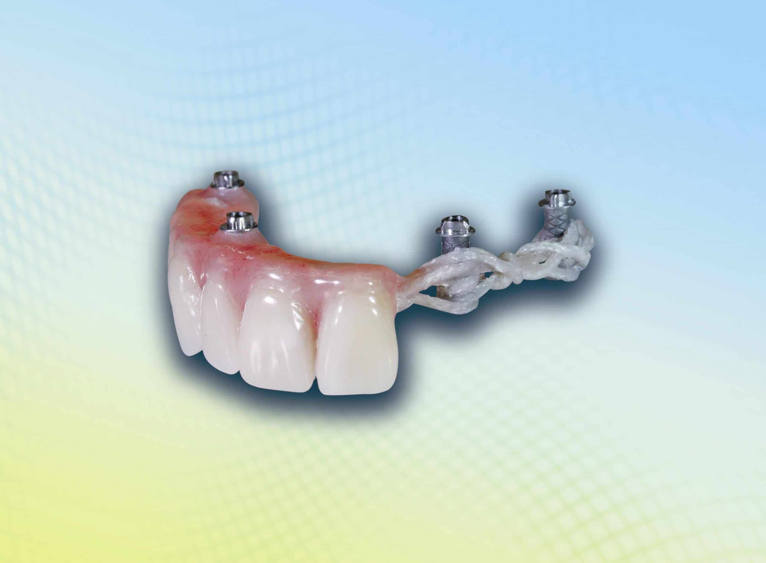 Sợi cáp chịu lực CST dùng cho hàm Implant - Bio Composants Médicaux