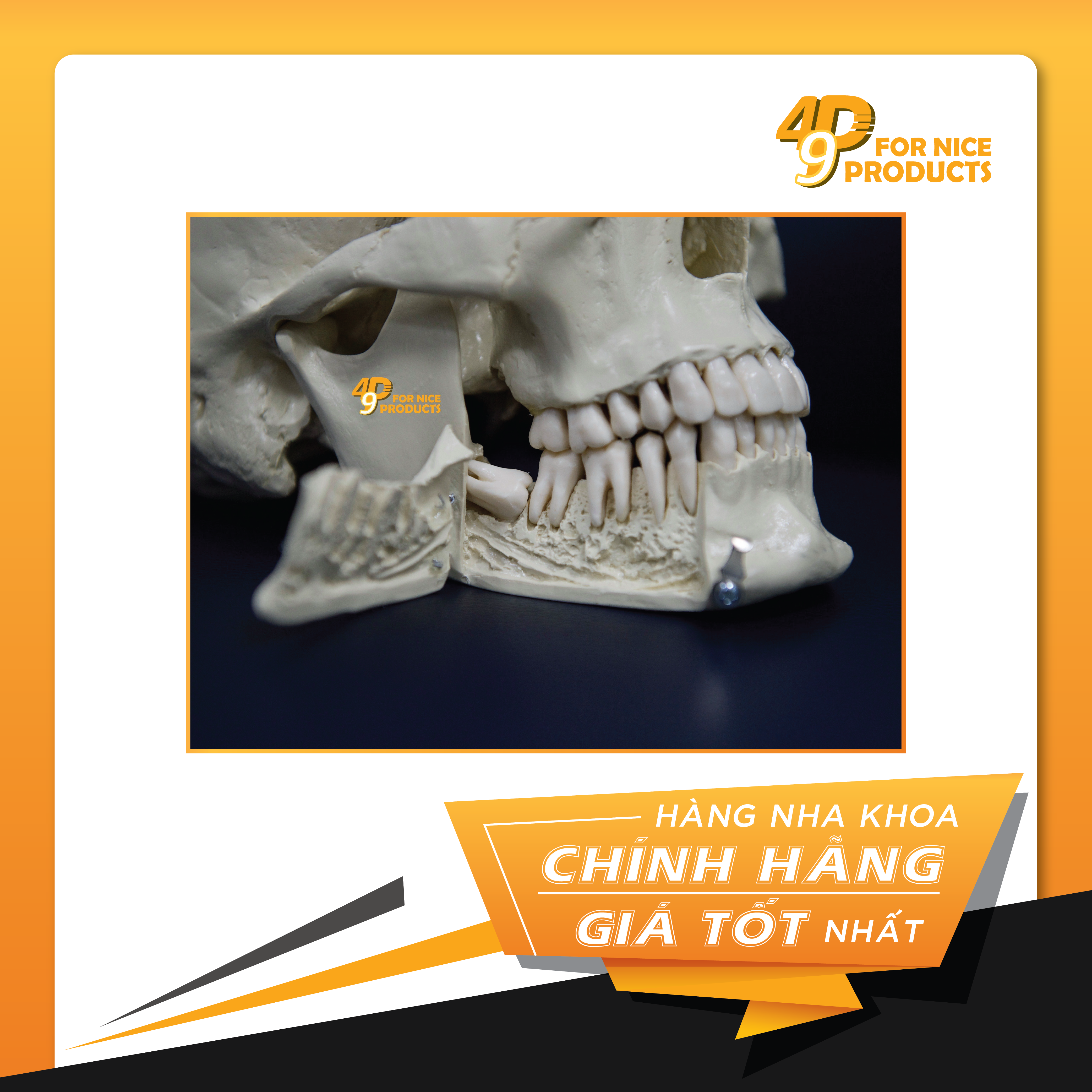 Sọ nhựa thực hành chỉnh nha - POS.
