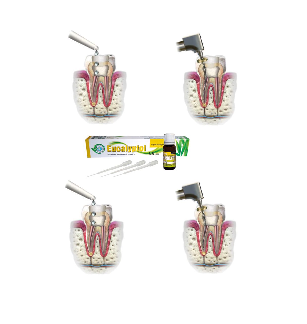 Dung dịch rã cone Eucalyptol -Cerkamed