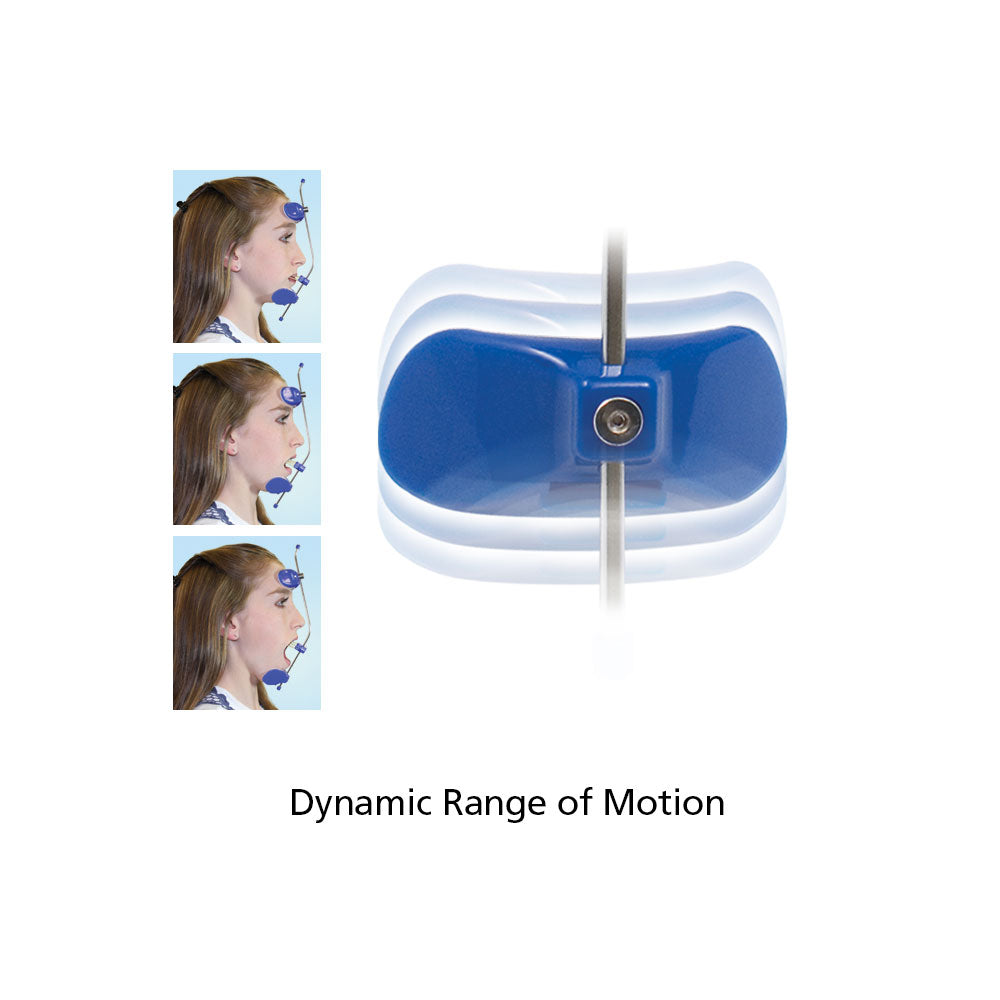 Khí cụ chỉnh nha ngoài mặt Facmask - Ortho Technology