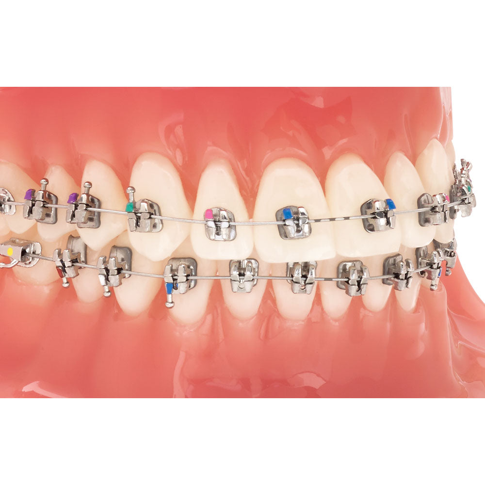 Mắc cài Kim loại tự buộc Lotus Plus DC - Ortho Technology