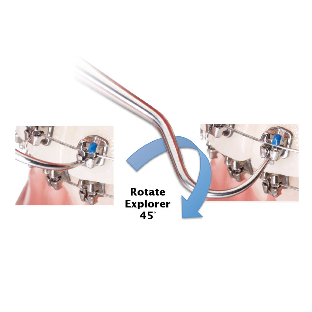 Mắc cài Kim loại tự buộc Lotus Plus DC - Ortho Technology
