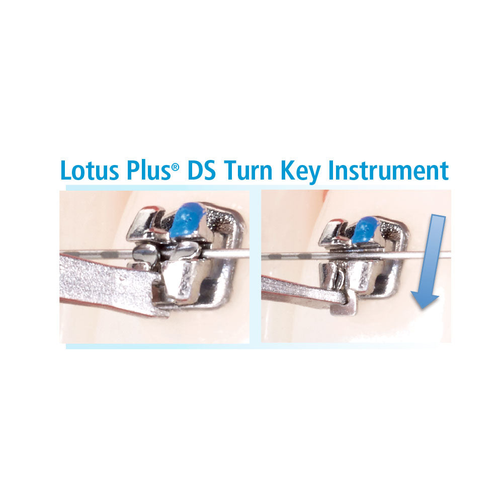 Mắc cài Kim loại tự buộc Lotus Plus DC - Ortho Technology