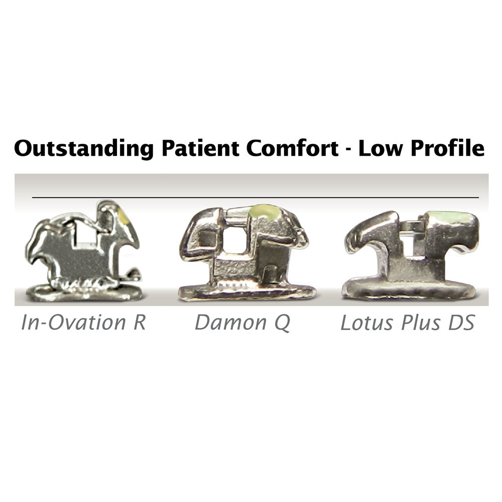 Mắc cài Kim loại tự buộc Lotus Plus DC - Ortho Technology