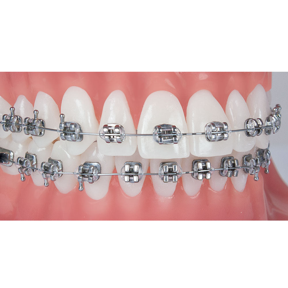 Mắc cài Kim loại thường Pinnacle - Ortho Technology