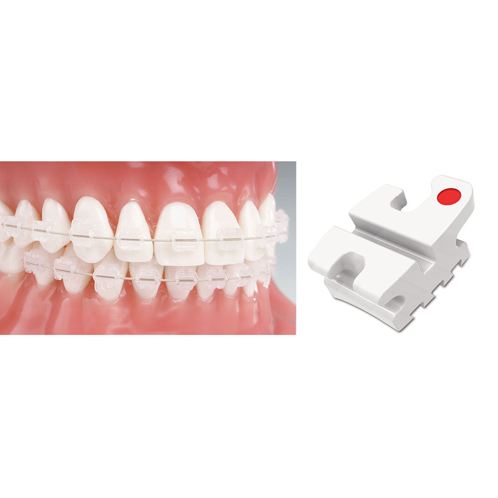 Mắc cài sứ thẩm mỹ Reflection  - Ortho Technology
