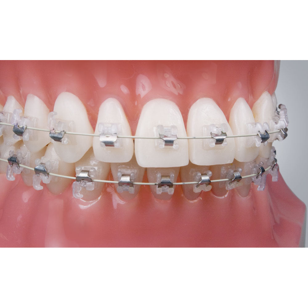 Mắc cài sứ tự buộc SensationM - Ortho Technology
