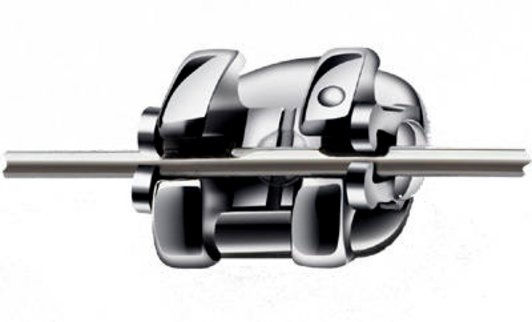 Mắc cài kim loại tự buộc SmarClip MBT -3M