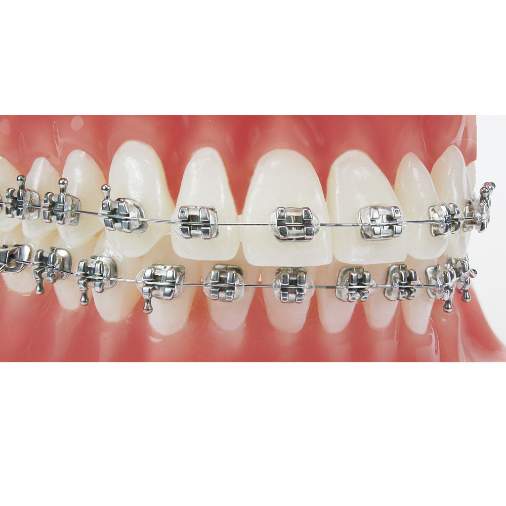 Mắc cài kim loại thường Votion - Ortho Technology