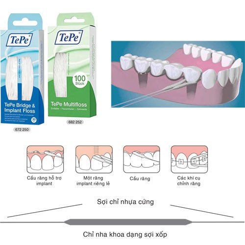 Chỉ Nha Khoa Cho Cầu Mão Răng Và Implant Tepe Bridge & Implant