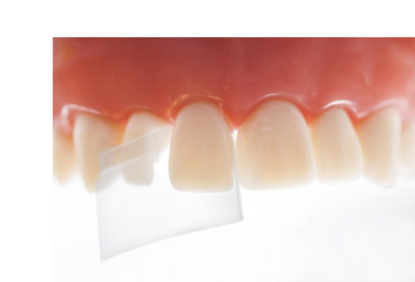 Đai trám trong suốt Directa®  Strips - Directa
